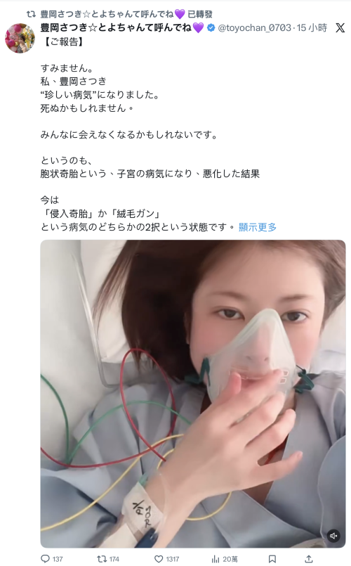 【博狗扑克】豊岡さつき(丰冈沙月)自爆罹患罕见疾病、可能致命!【EV扑克下载】 【博狗扑克】豊岡さつき(丰冈沙月)自爆罹患罕见疾病、可能致命!【EV扑克下载】